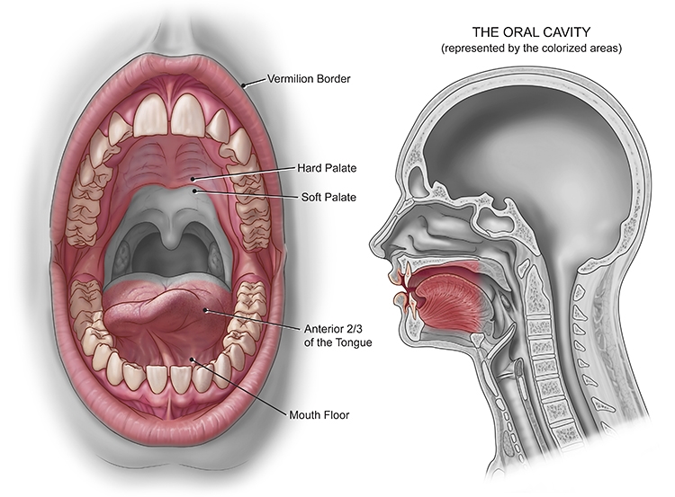 Ung thư miệng – Nguyên nhân và cách điều trị bệnh ung thư miệng
