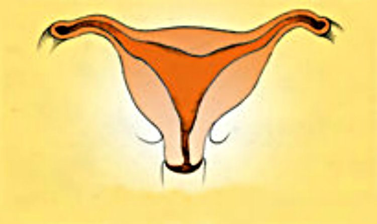 Bất thường ở tử cung ảnh hưởng đến khả năng sinh sản
