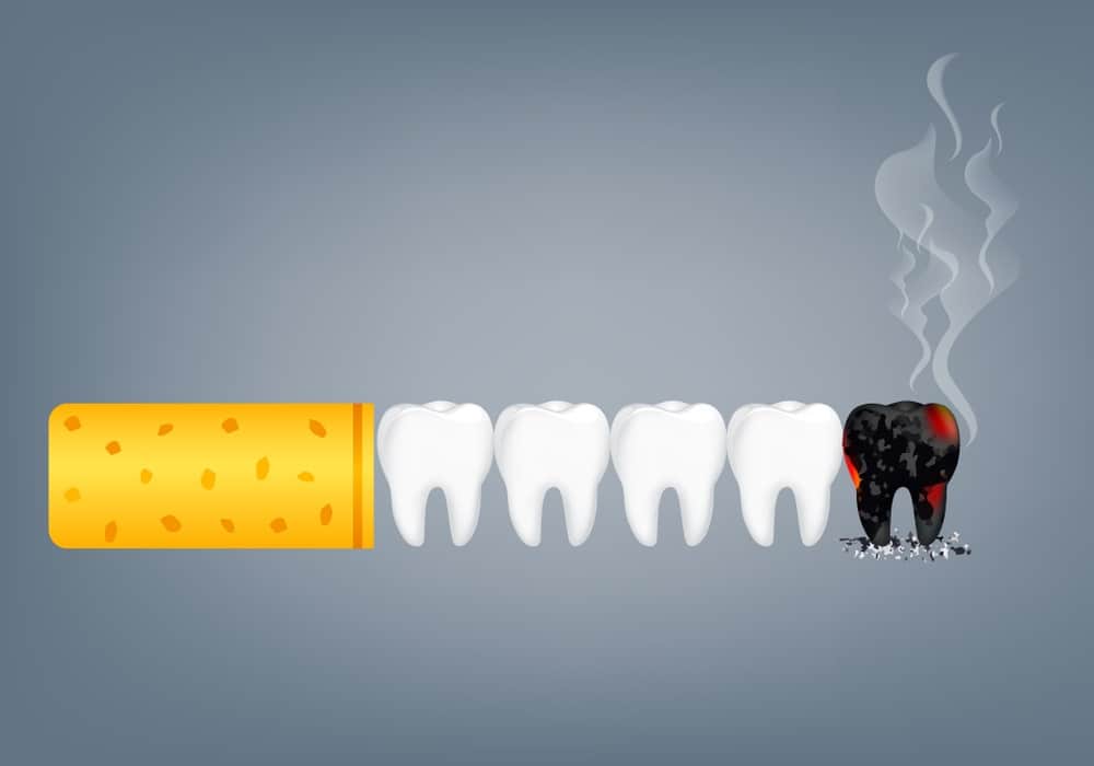 Hút thuốc lá có hại cho răng miệng ra sao? Cách bỏ thuốc lá hiệu quả