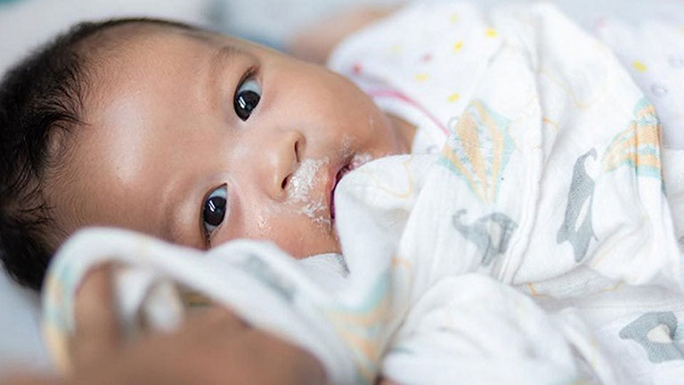 Nôn trớ ở trẻ sơ sinh: Nguyên nhân và cách xử lý an toàn