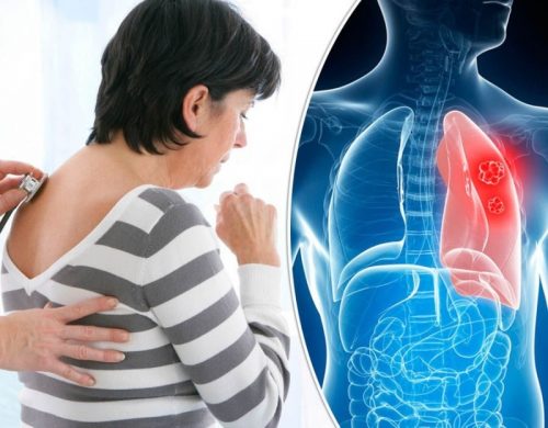 Đau sau lưng vùng phổi trái, phải là bệnh gì và nguy hiểm không?
