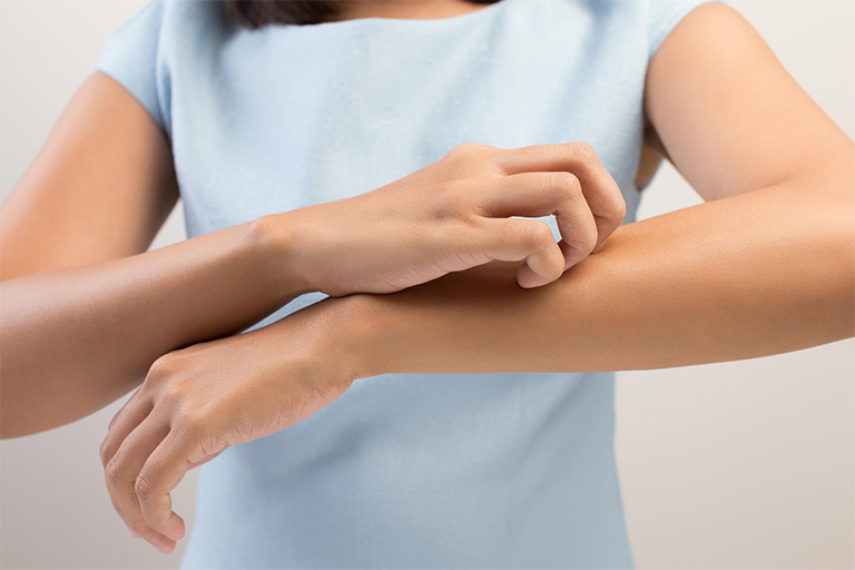 Nổi mẩn ngứa ở chân tay – Nguyên nhân và cách xử lý