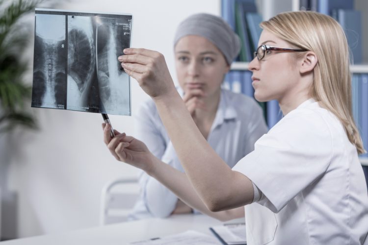 Ung thư phổi giai đoạn cuối: Triệu chứng, tiên lượng, điều trị và chăm sóc