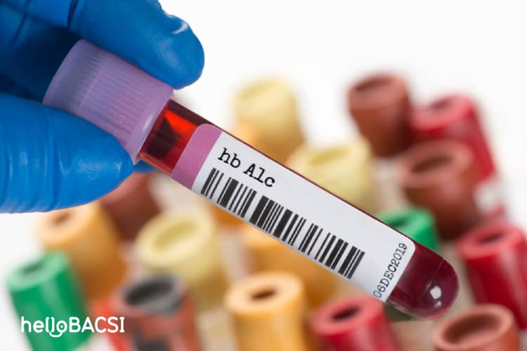 Xét nghiệm huyết sắc tố A1C kiểm tra bệnh tiểu đường