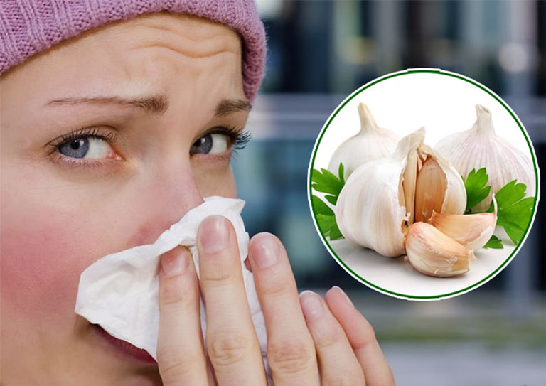 6 cách chữa viêm mũi dị ứng bằng tỏi cực hay giúp nhanh khỏi bệnh