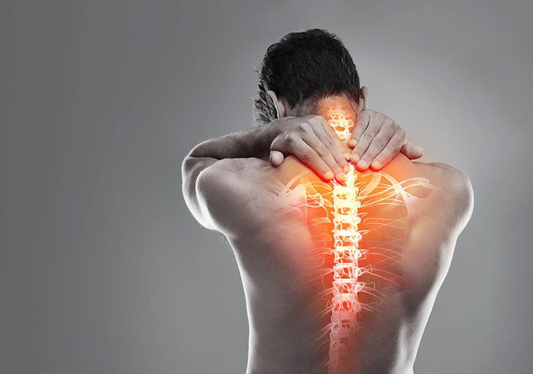 Chứng đau cổ do nguyên nhân nào gây ra? Nên làm gì để điều trị?