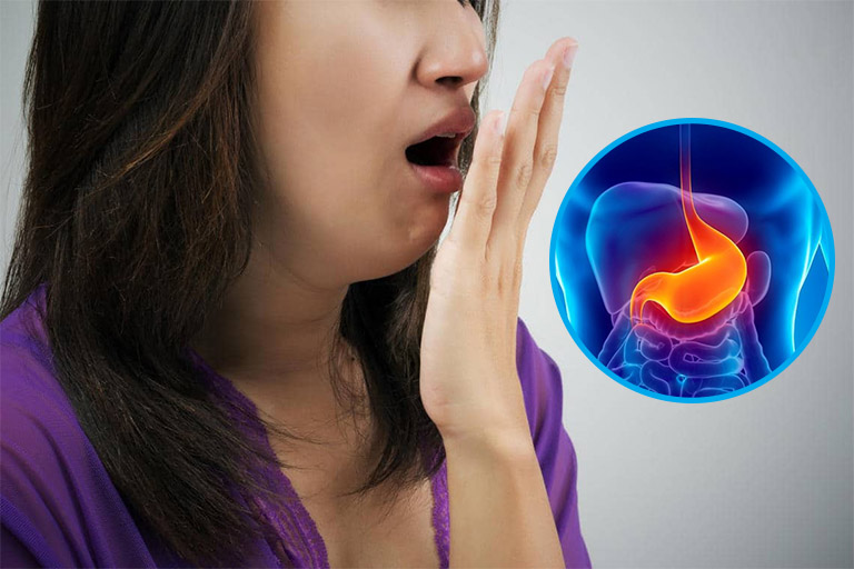 Hở van dạ dày gây hôi miệng và cách khắc phục