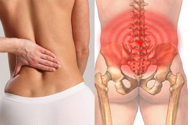 Bệnh đau lưng là gì? Nguyên nhân triệu chứng và cách trị an toàn nhất