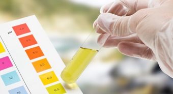 Có thể dự đoán nguy cơ ung thư cổ tử cung dựa trên xét nghiệm nước tiểu