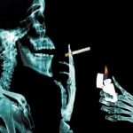 Hút thuốc lá là nguyên nhân gây ung thư tủy xương