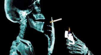 Hút thuốc lá là nguyên nhân gây ung thư tủy xương