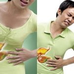 Những điều cần biết khi bạn bị đau dạ dày