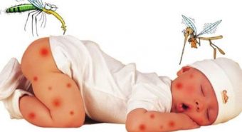 Phương pháp phòng chống dịch sốt xuất huyết