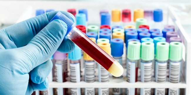 Xét nghiệm các mẫu máu có thể giúp phát hiện ung thư và định hướng phương pháp điều trị