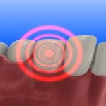 Vệ sinh răng miệng kém là “thủ phạm” gây bệnh ung thư lưỡi