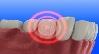 Vệ sinh răng miệng kém là “thủ phạm” gây bệnh ung thư lưỡi