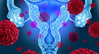 Virus HPV gây ung thư cổ tử cung lây qua đường nào?