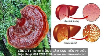 Nấm lim xanh Tiên Phước có tác dụng gì trong việc đẩy lùi mỡ máu?