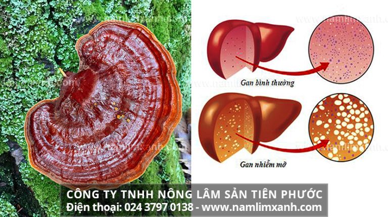 Nấm lim xanh Tiên Phước có tác dụng gì trong việc đẩy lùi mỡ máu