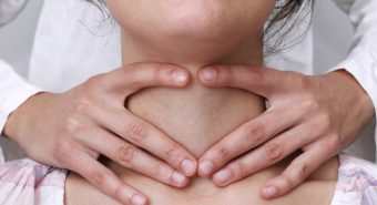 Bướu giáp ở phụ nữ có thể phát triển gấp 5 lần nam giới