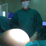 Bệnh viện K phẫu thuật thành công khối u buồng trứng nặng 16kg