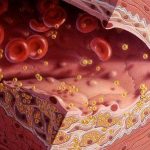 Chế độ ăn khoa học cho người máu nhiễm mỡ