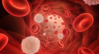 Ngăn ngừa ung thư máu bằng phương pháp trẻ hóa máu trong cơ thể
