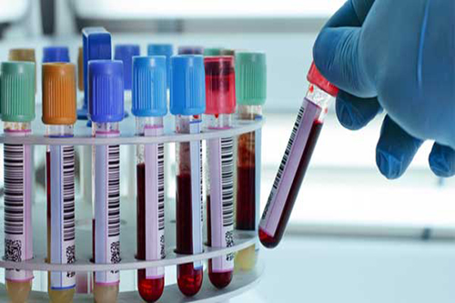 Xét nghiệm chuyên biệt giúp chẩn đoán viêm gan C