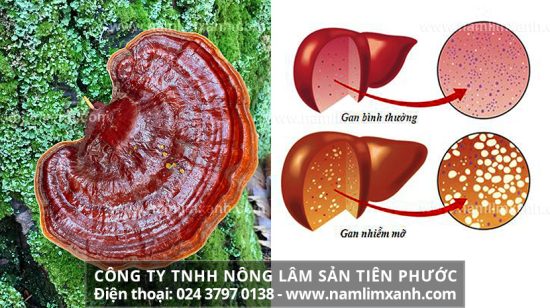 Nấm lim xanh chữa bệnh gan nhiễm mỡ