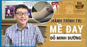 10+ loại thuốc chữa dị ứng thời tiết tốt nhất hiện nay [Đã Kiểm Chứng]