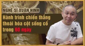 Vôi hóa cột sống uống thuốc gì? – TOP thuốc tốt nhất hiện nay