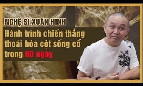 Vôi hóa cột sống uống thuốc gì? – TOP thuốc tốt nhất hiện nay